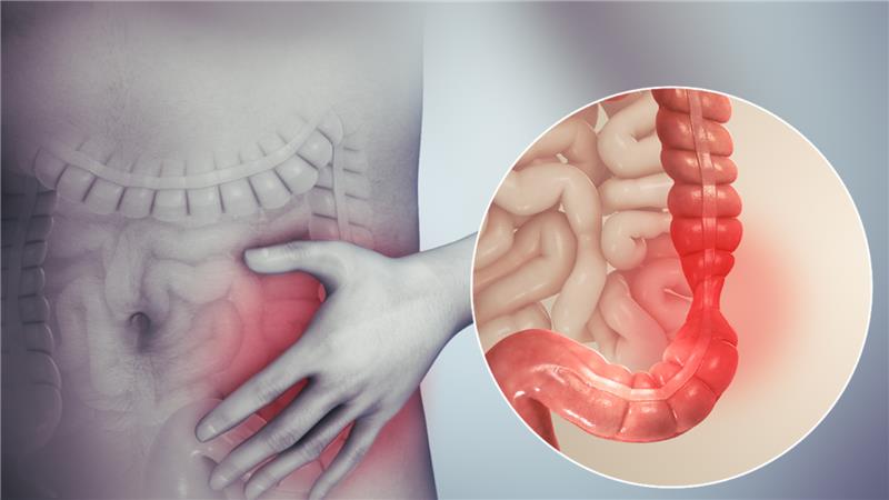 Inflamación